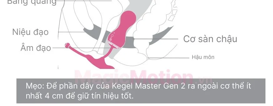 Vị trí đặt Kegel Master Gen 2 khi tập kegel